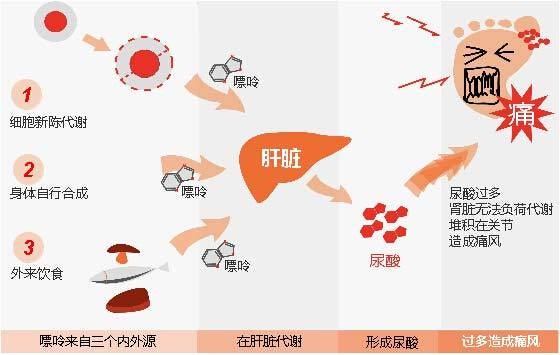 为什么夜场的人不得痛风 为什么夜场的人不得痛风病