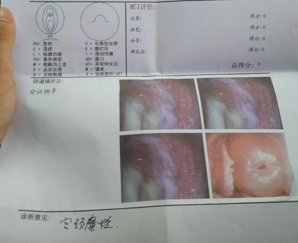 夜场女人宫颈手术多少钱 女人宫颈做手术了,会影响什么吗