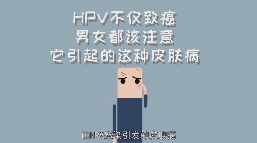 夜场工作的人感染hpv怎么做 去夜店会传染什么病